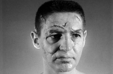 Terry Sawchuk - The face of a hockey goalie before masks became standard game equipment, 1966