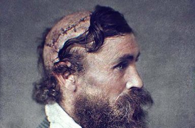 Robert McGee, the man who was scalped as a child by Native American warriors, 1864