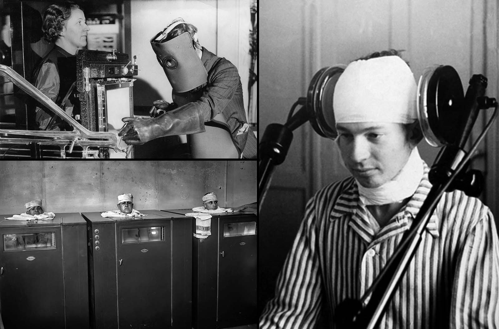 These photos show terrifying and strange medical devices from history, 1900s-1950s