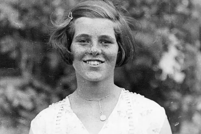 Rosemary Kennedy Lobotomy Vintage Photos