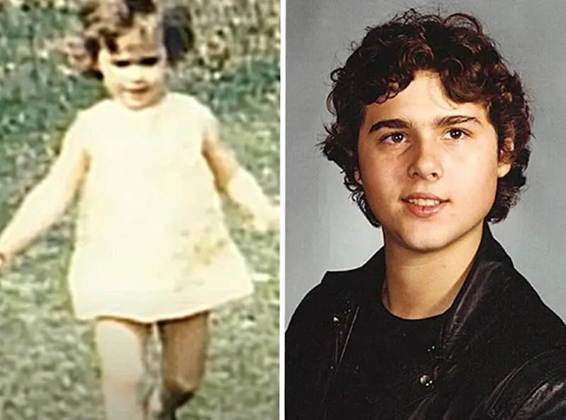 David Reimer Story In Photos, Boy Forced to be Raised as a Girl